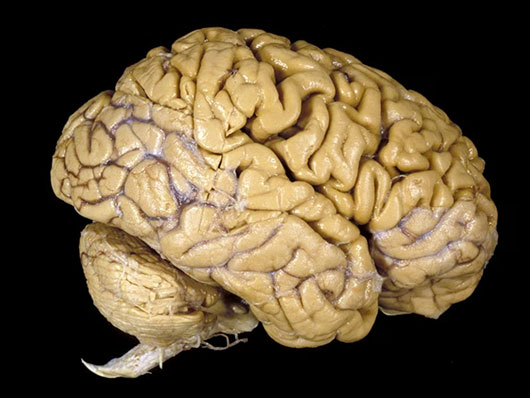 Preserved specimen of the Human Brain